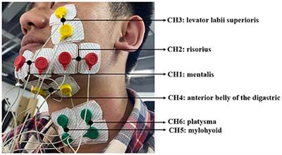 A novel silent speech recognition approach based on parallel inception convolutional neural network and Mel frequency spectral coefficient